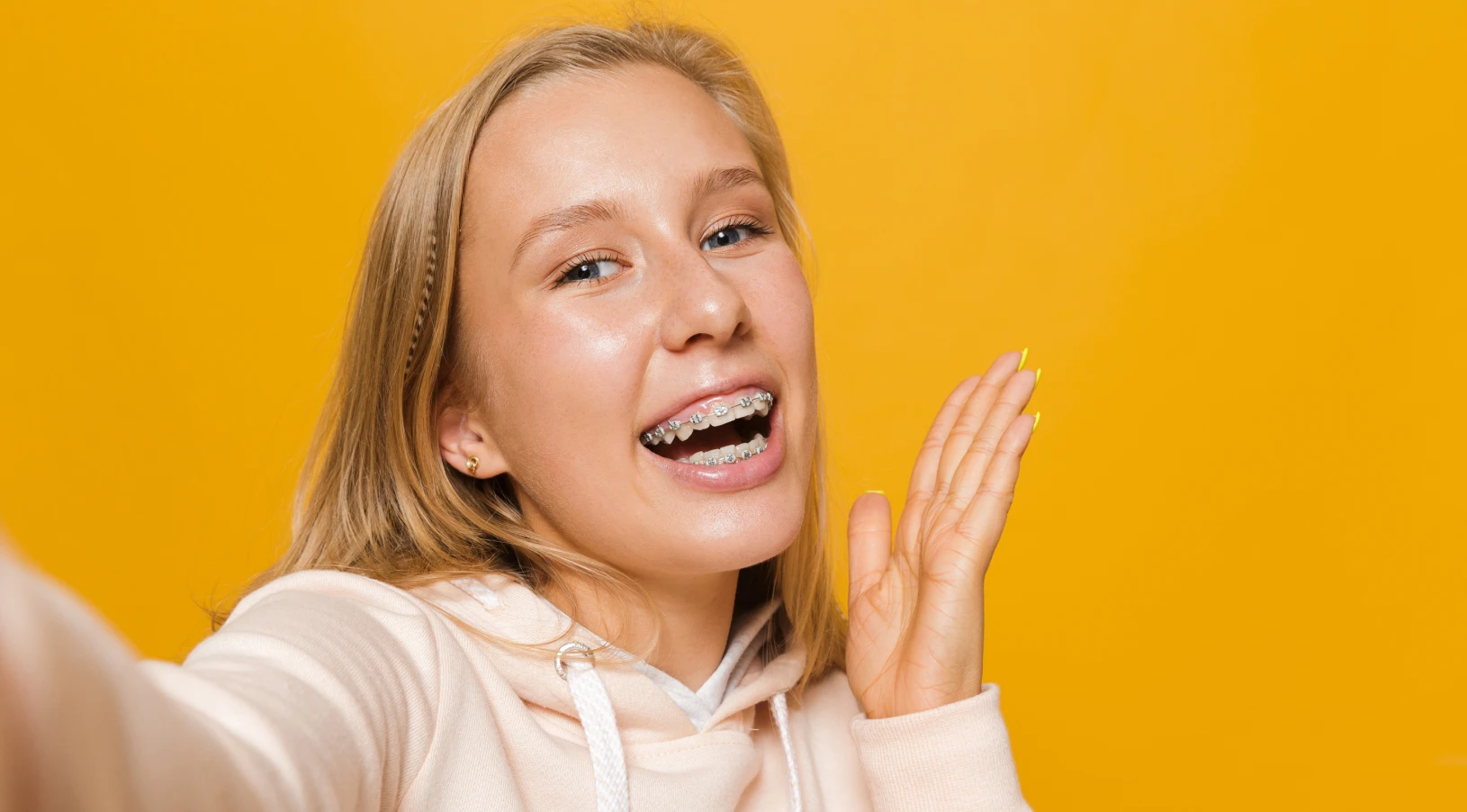 multi-bagues-adolescents orthodontiste nice