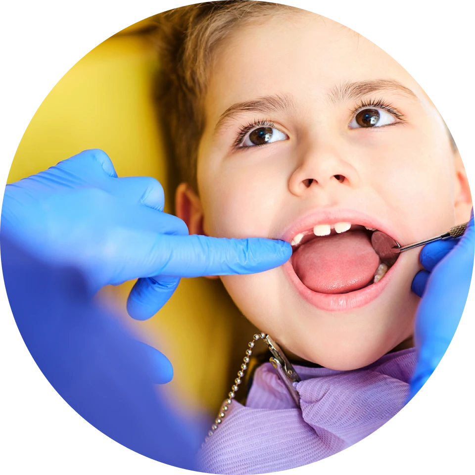 traitement caries dentiste nice